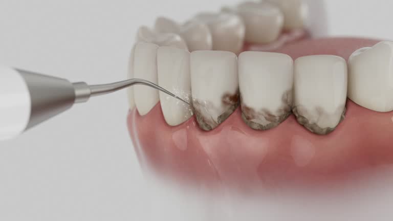 Trusted Tooth Extraction service in Phillipsburg, GA - Dentist Open Now
